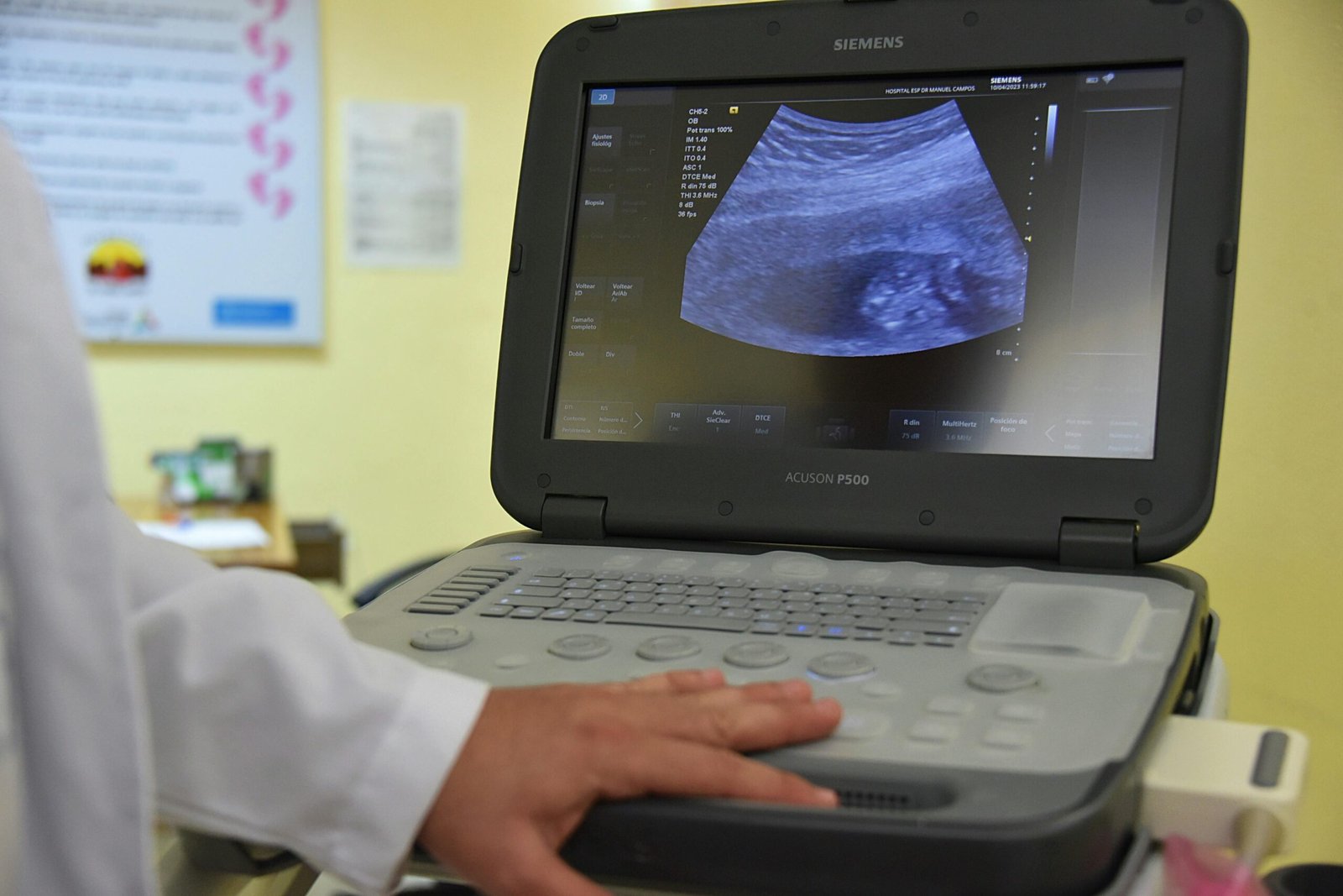 A close-up of a doctor performing an ultrasound scan, focusing on medical technology in practice.